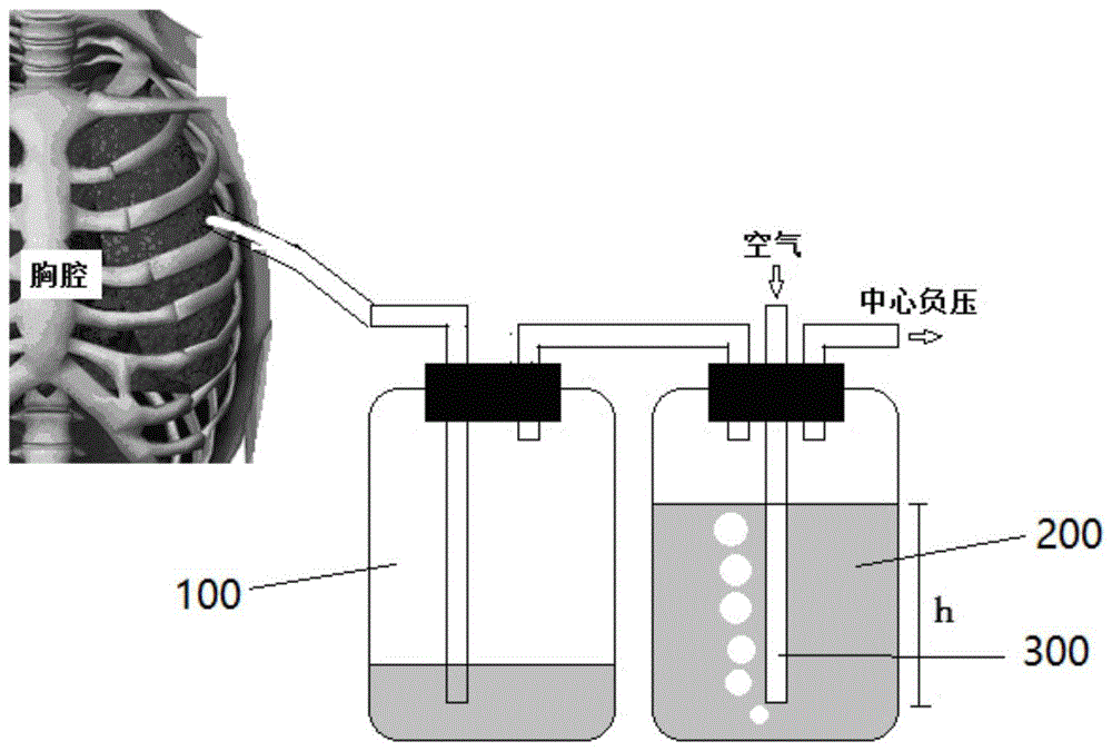 基於伯努利原理的負壓輔助胸腔閉式引流裝置的製作方法