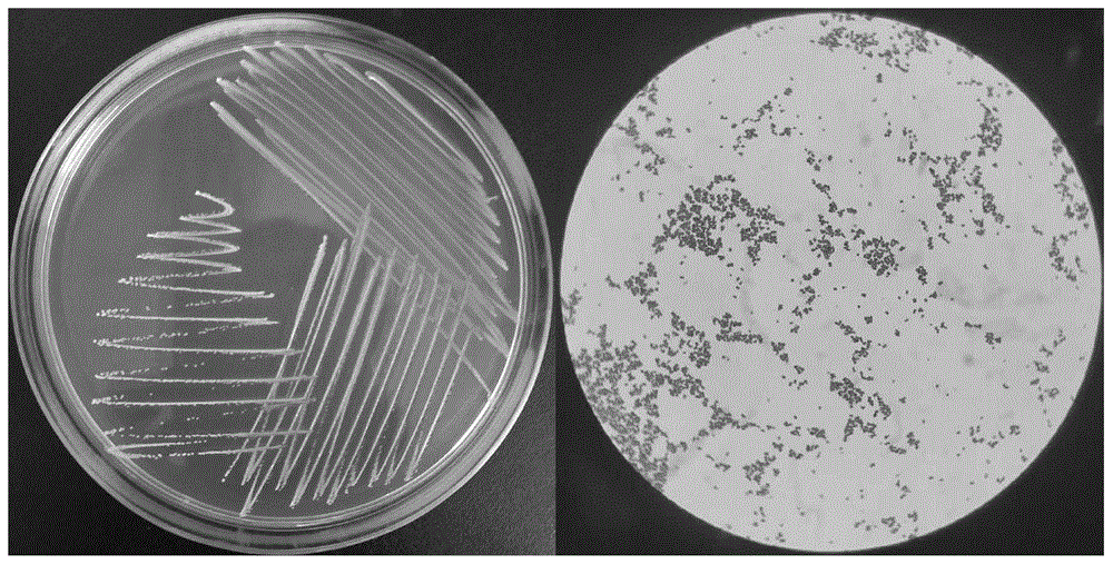 乳酸链球菌显微镜图片图片