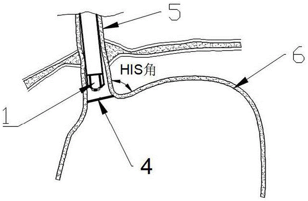 his角解剖图图片