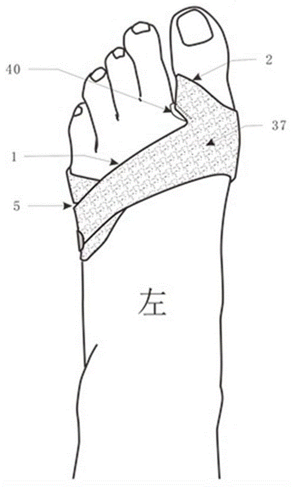 一组加强足横弓调整的外出型拇外翻矫正带的制作方法