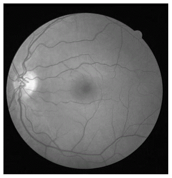 一種視網膜圖像血管分割方法與流程