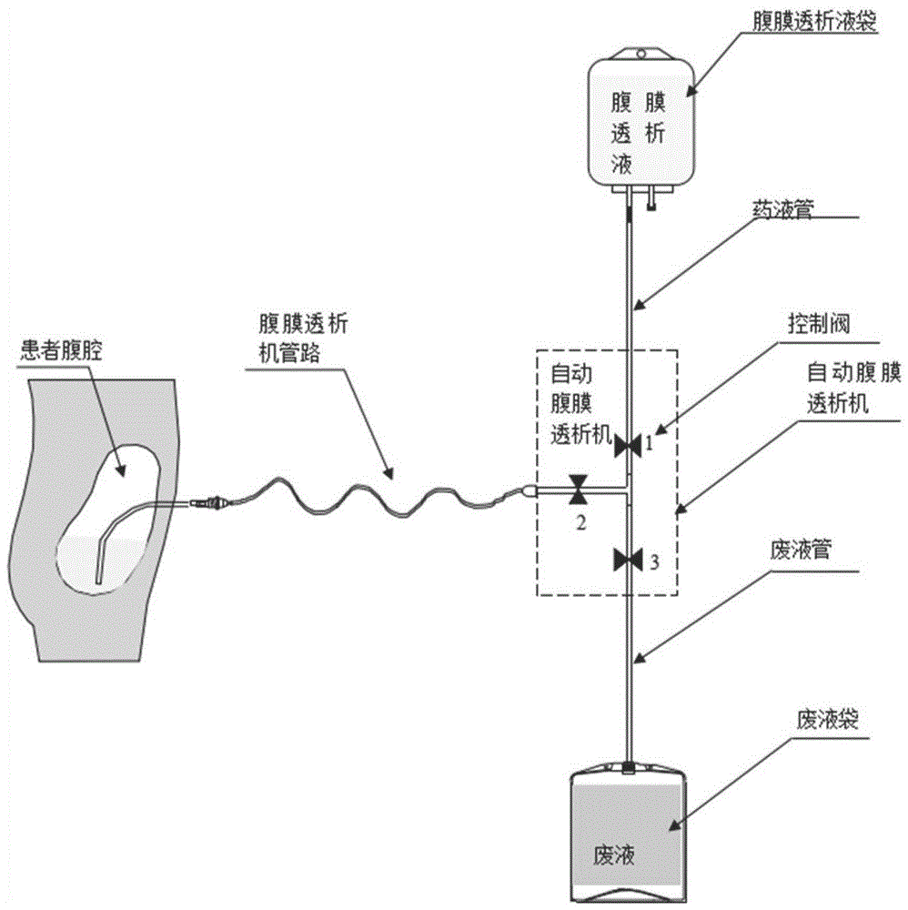 腹膜透析机管路图片