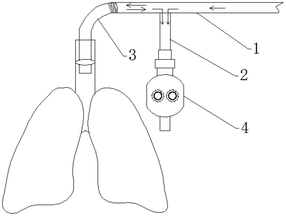 一种恒流式低无效腔呼吸机的制作方法