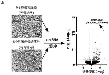 circikbkb的抑制劑及其檢測試劑在乳腺癌骨轉移診斷治療和預後試劑盒