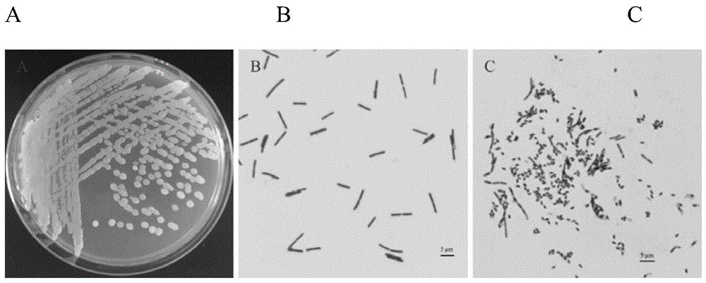 一株鱧源貝萊斯芽孢桿菌及其應用的製作方法