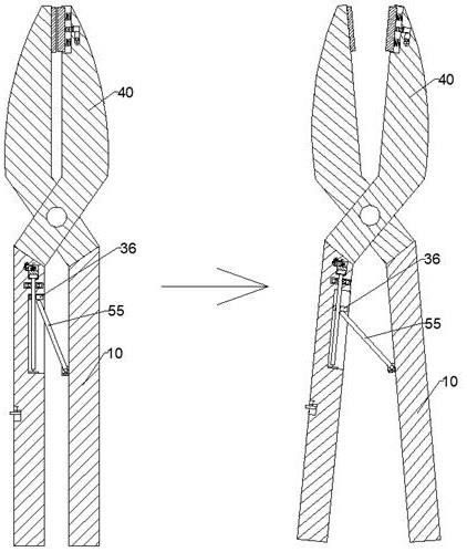 拔牙工具简笔画图片图片