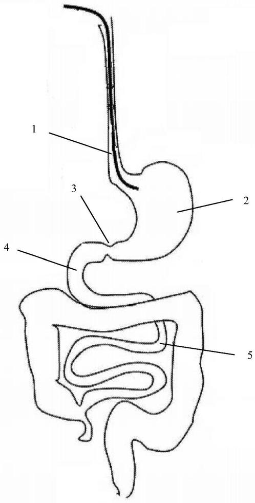 食道手绘图图片