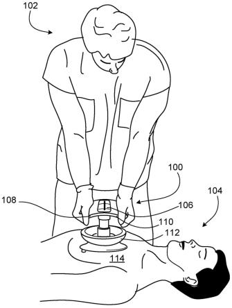 用于辅助主动按压减压CPR的系统和存储介质的制作方法