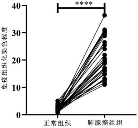 MRPL12蛋白在制备肺腺癌检测产品中的应用的制作方法