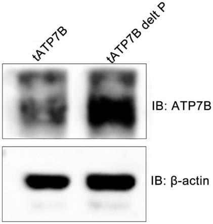 一种表达量提高的截短型ATP7B基因及其应用的制作方法