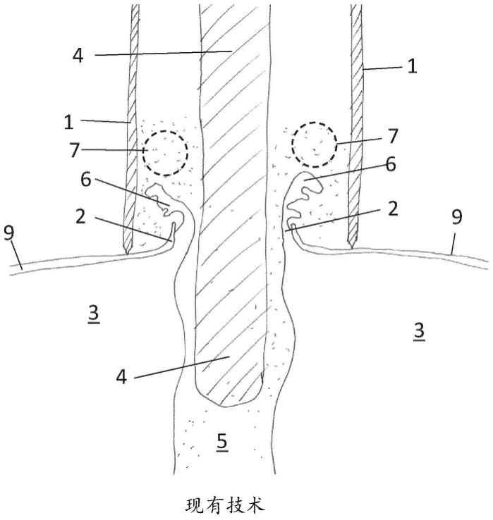 具有塞保持器的塞钻器的制作方法