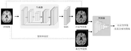 基于深度学习的3T磁共振图像生成7T磁共振图像的方法与流程