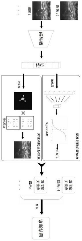 基于经典Graf的DDH超声影像人工智能诊断系统及方法