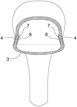 四翼阴道扩张器的制作方法