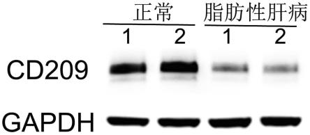 抗炎CD209多肽片段及其抗脂肪性肝病炎症的应用