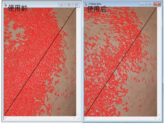 一种温和的亮肤组合物及其应用的制作方法