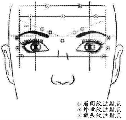 上部面纹的处理的制作方法