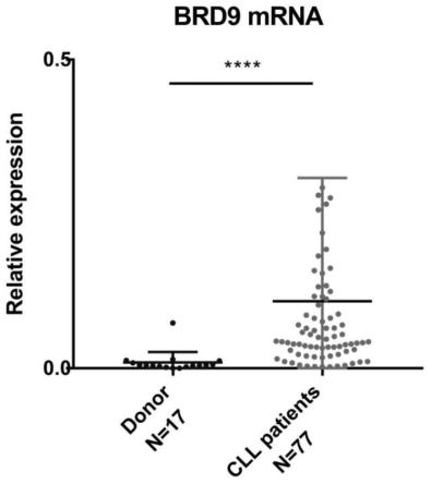 BRD9在慢性淋巴细胞白血病诊治中的应用