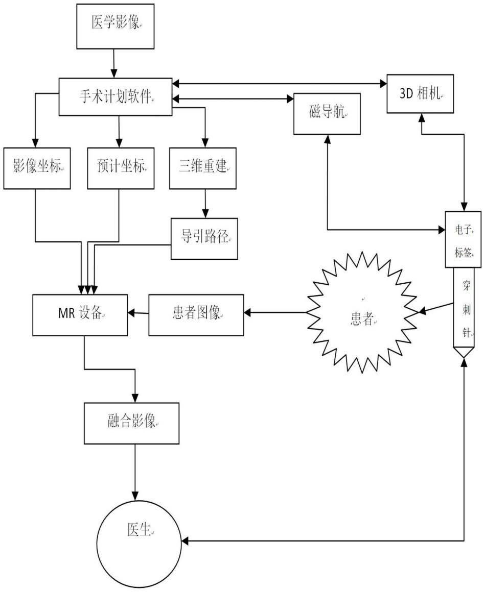 一种基于混合现实肿瘤微创手术的设计方法与流程