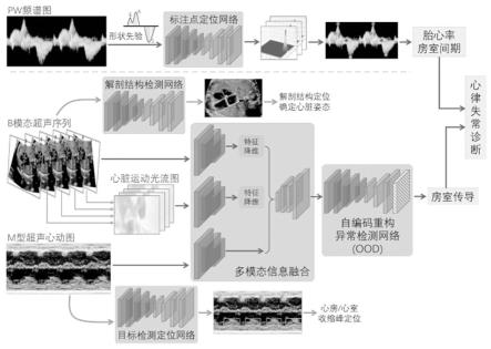 基于跨模态图像融合与阳性小样本学习的胎儿心律失常智能诊断方法与流程