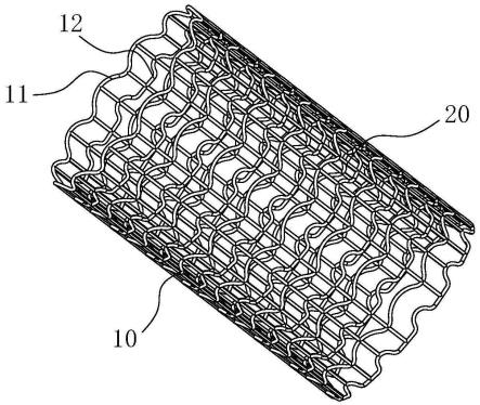 血管支架的制作方法