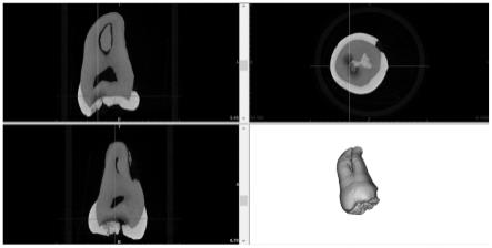 制作显微CT中指定影像断层的牙齿磨片的方法
