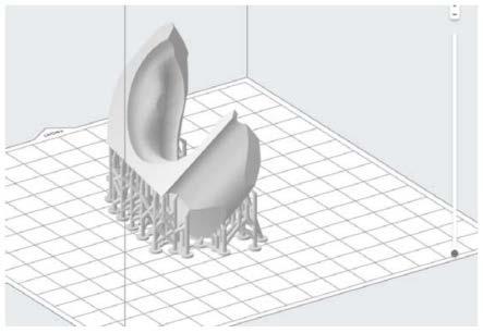 一种个性定制耳廓矫形器3D打印制造方法与流程
