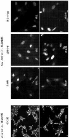 基因治疗