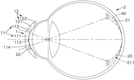 角膜塑型片的光心及多弧段镜片的结构的制作方法
