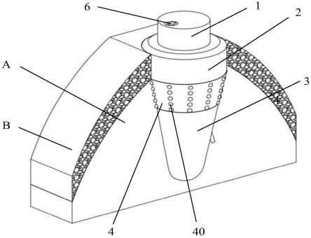 一种个性化激光纯钛3D打印仿生牙根式种植牙的固位装置的制作方法