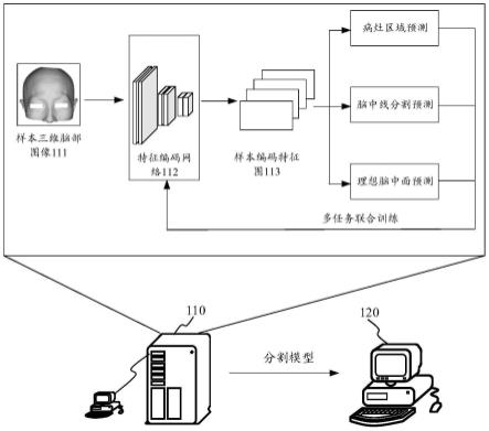 三维脑中线分割方法、装置、设备、存储介质及程序产品