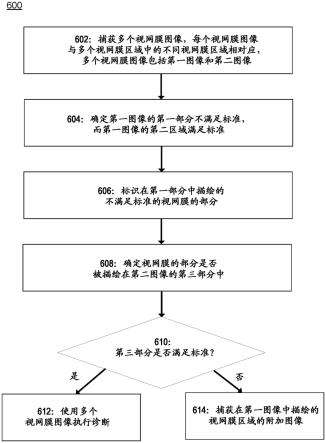 用于最小闪光的眼病诊断的图像保留和拼接的制作方法