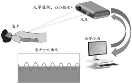 基于激光测距的呼吸运动管理系统及方法