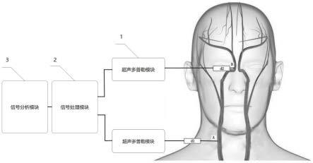 一种实现无创脑动脉僵硬度检测系统及方法与流程