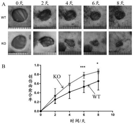 Kindlin-2作为靶点在皮肤创伤修复中的应用
