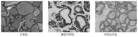 自身免疫性甲状腺疾病颈用贴敷药物及其制备工艺的制作方法