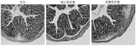 瑞士乳杆菌菌株及含有其的用于预防或治疗炎性疾病的组合物的制作方法