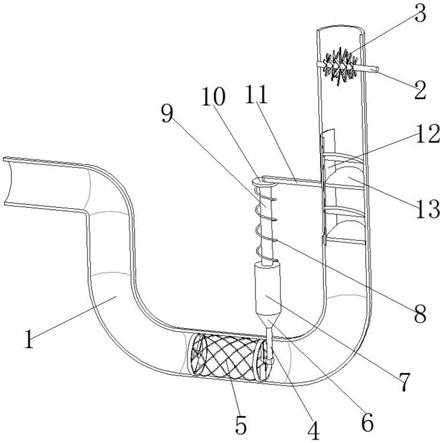 排污管防堵塞装置图片