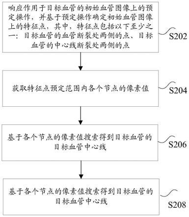 血管模型的处理方法及其装置、计算机可读存储介质与流程