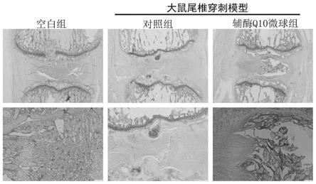 辅酶Q10在制备脊柱老化性疾病治疗药物中的应用