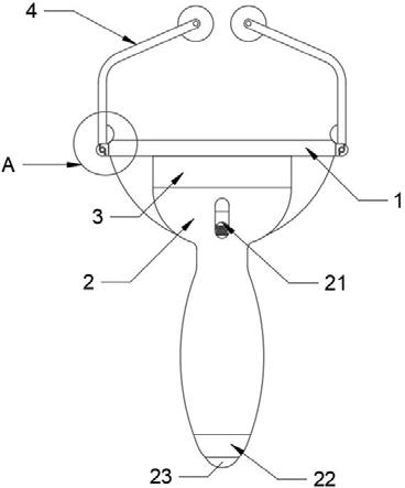 一种美容外科的便携式矫正器的制作方法