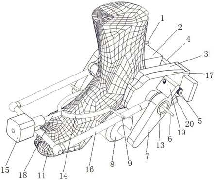 一种用于跟骨骨折复位的自动化装置及其使用方法与流程