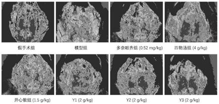 改善脑缺血的药物组合物及其应用