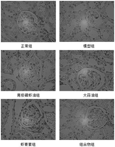 一种能够降低血清中高尿酸水平的组合物及其应用的制作方法