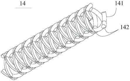 编织支架和编织支架系统的制作方法