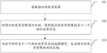 一种病灶区域识别方法、装置、电子设备和存储介质与流程