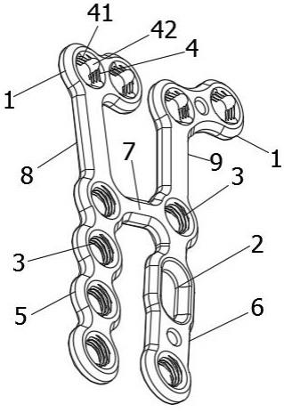 尺骨半腕连接板的制作方法