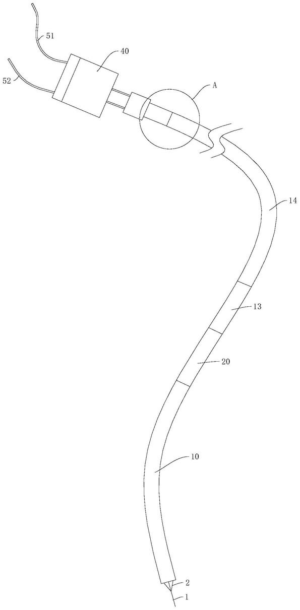 一种用于肝脏介入手术的门体静脉支架及其使用方法与流程