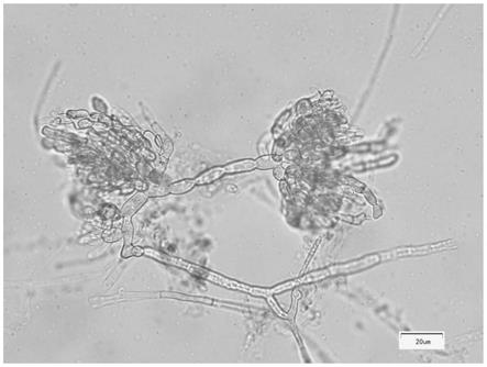 一种诱导禾谷镰刀菌大量产孢及制备孢子液方法