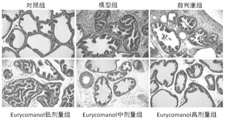 Eurycomanol在制备防治非细菌性前列腺炎药物、食品及保健品中的应用